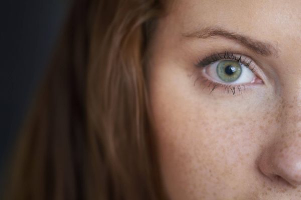 Pigmentflecken mit Laser behandeln Dortmund